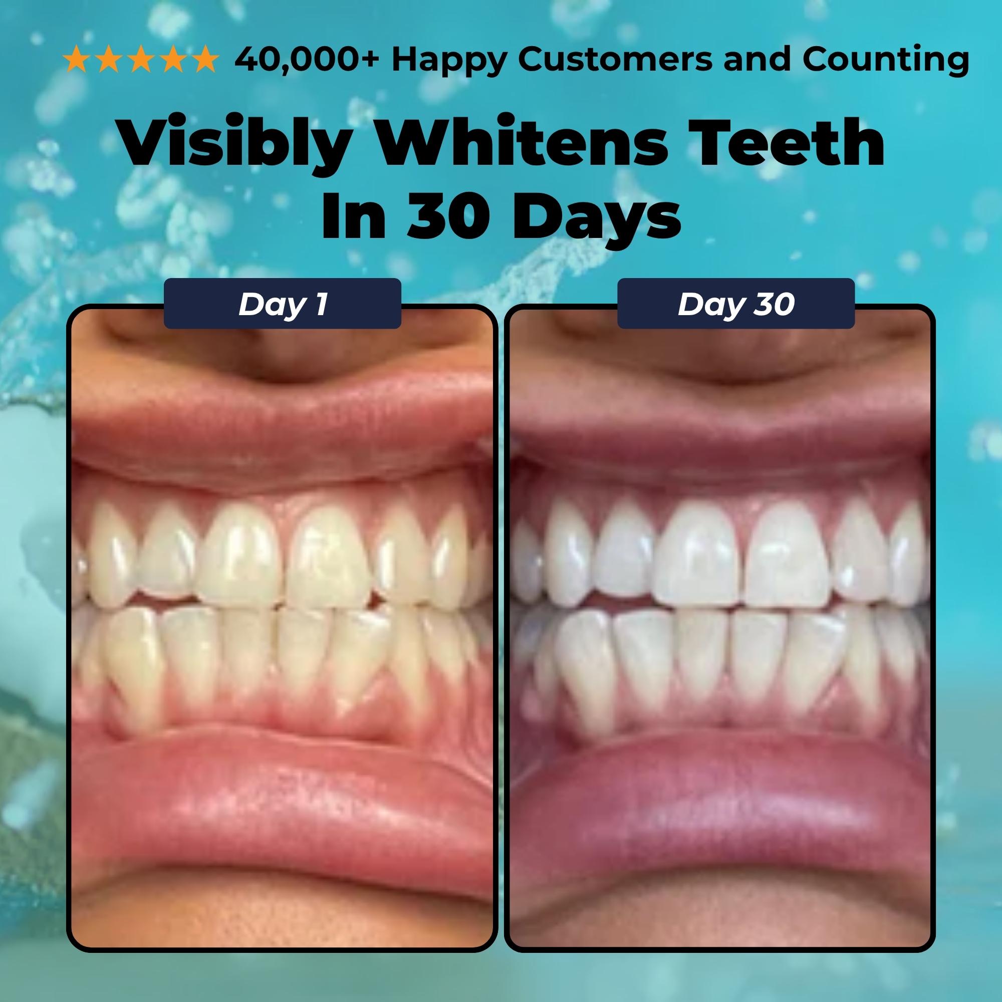 Ice&Ivy™ Coconut Pulling Oil Mouthwash