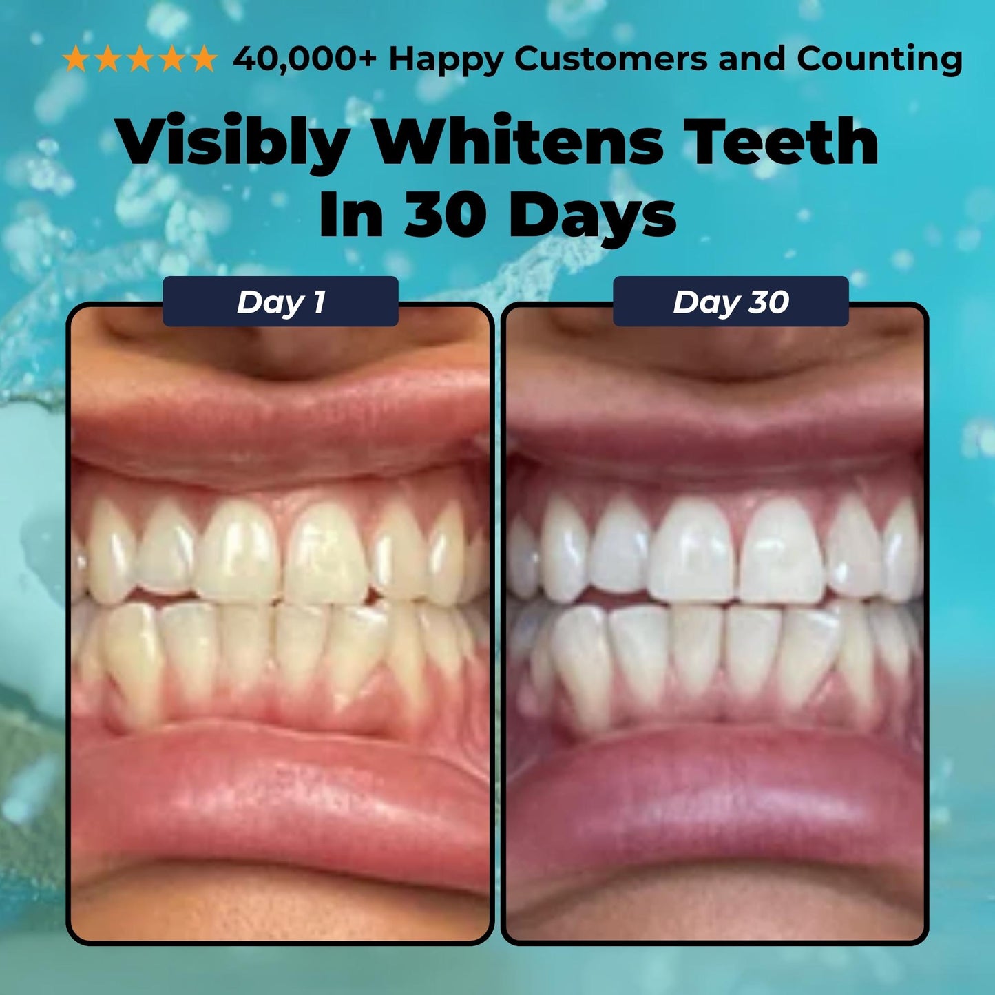 Ice&Ivy™ Coconut Pulling Oil Mouthwash